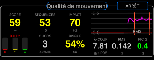 Zone centrale Camera Rig